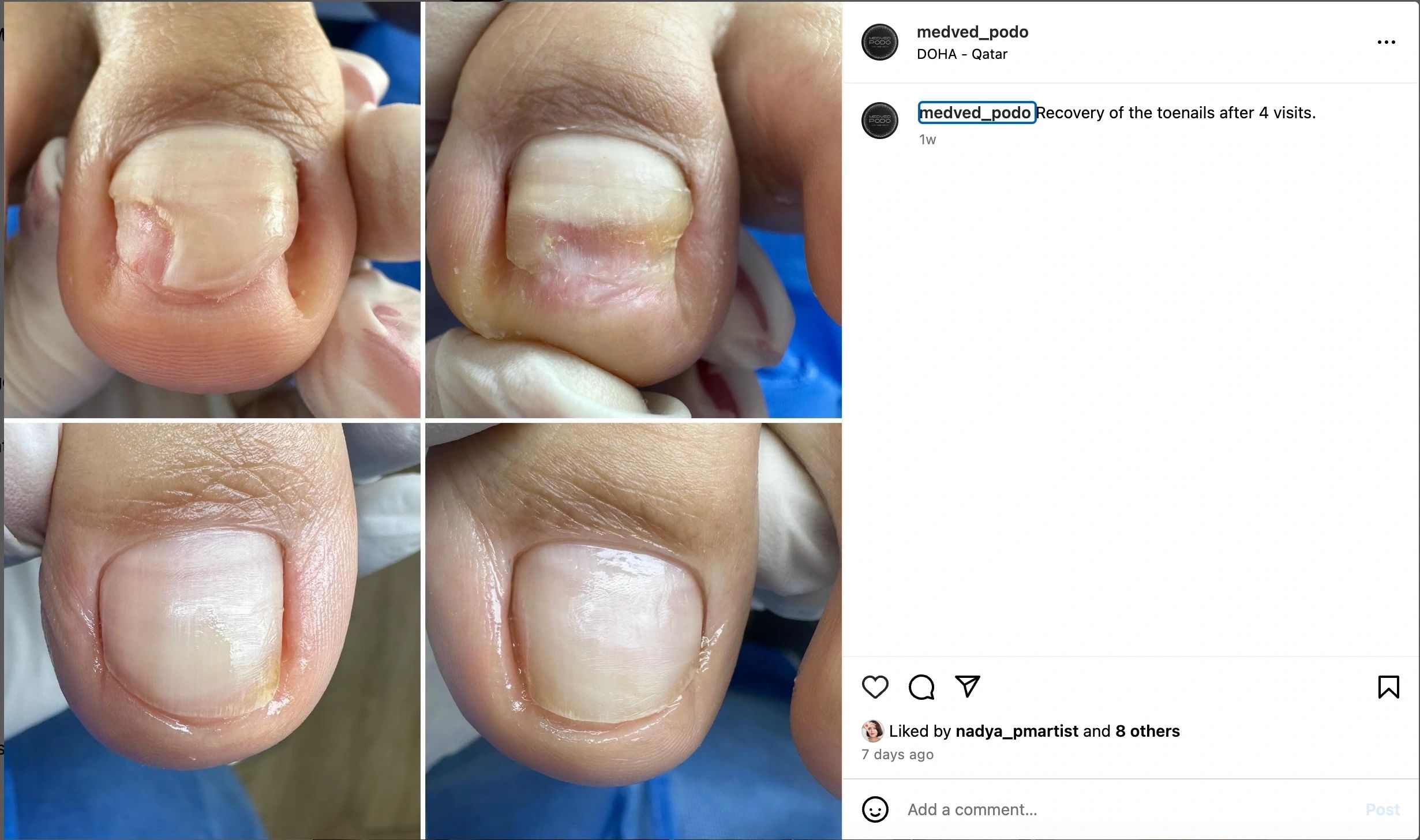 Before and after foot care treatment